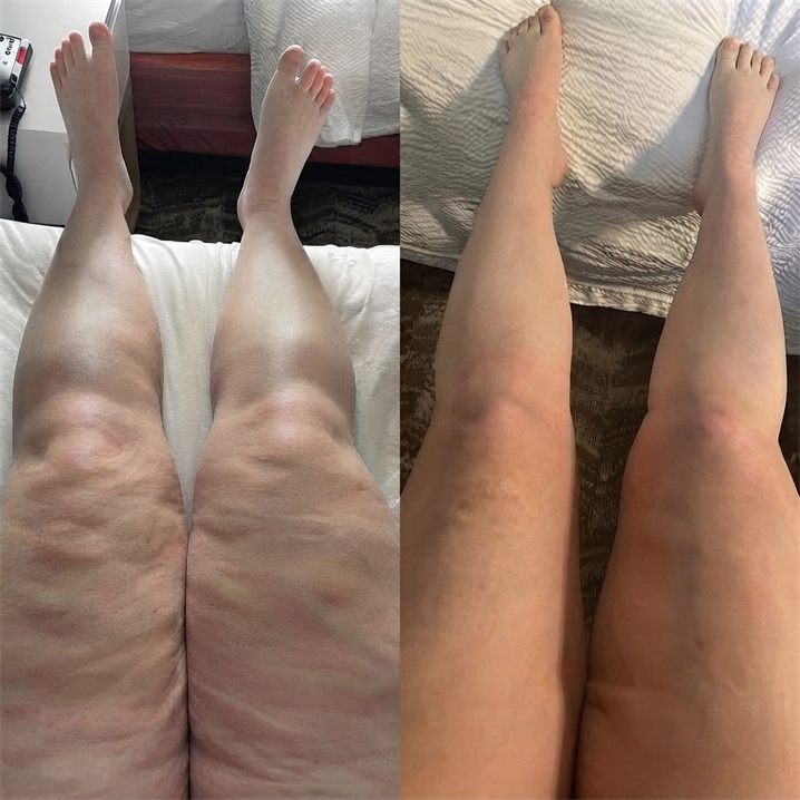 Melissa T. — before and after