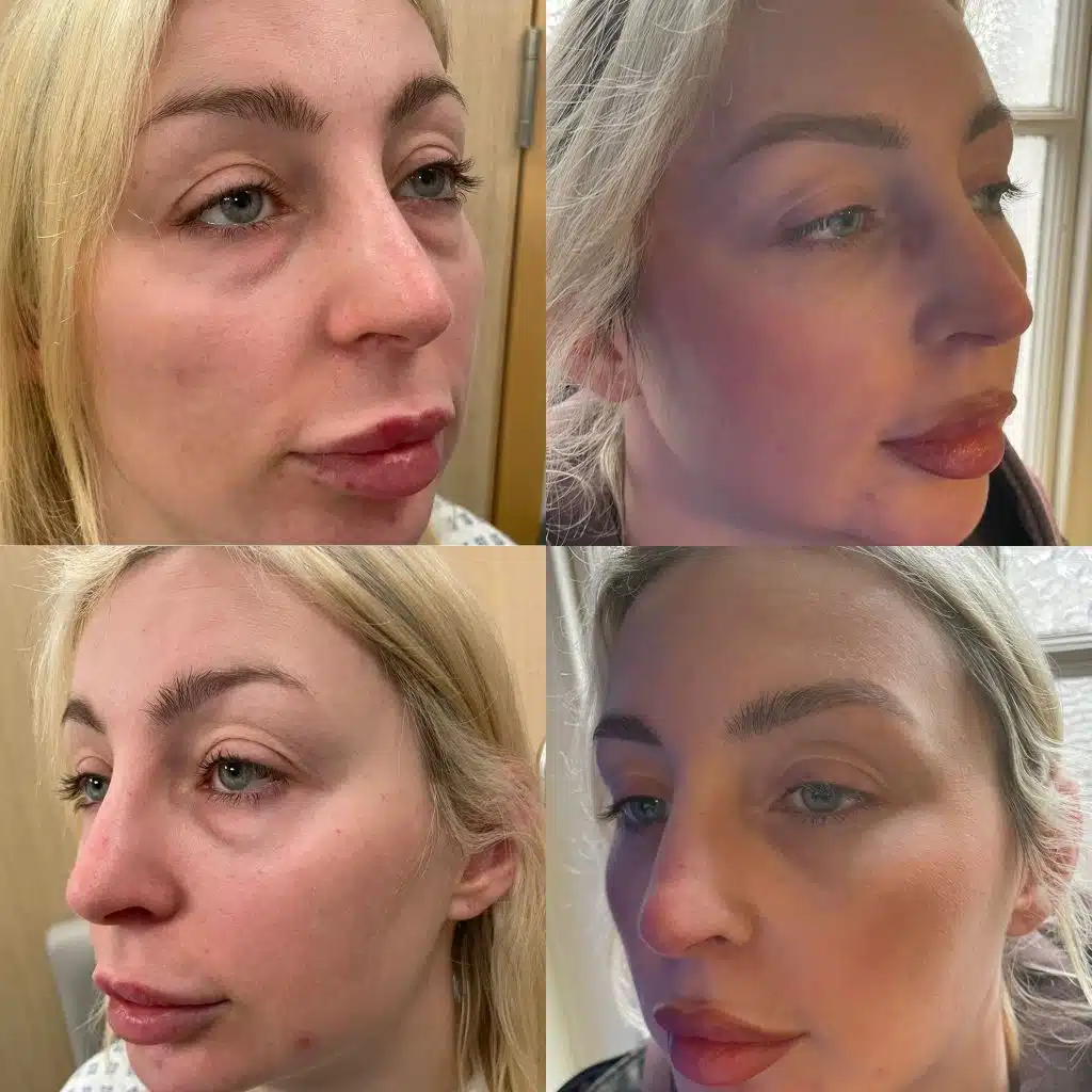 Nicole S. — before and after